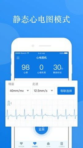 ai ecg0