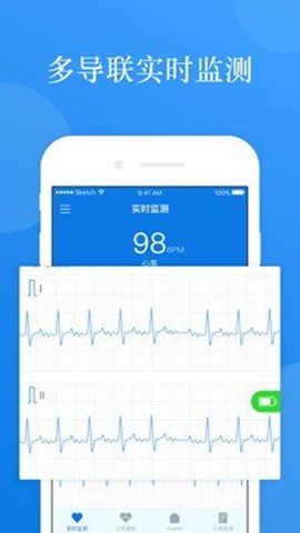 ai ecg1